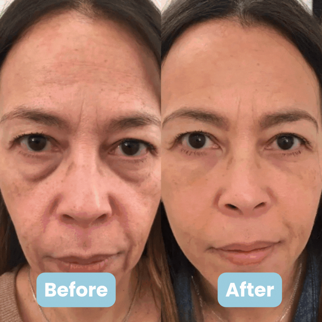 GlowTech™ LIFT7 Pro