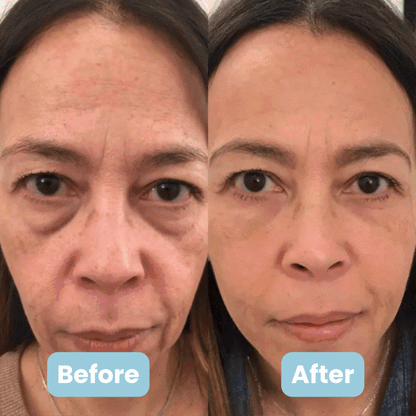 GlowTech™ LIFT7 Pro